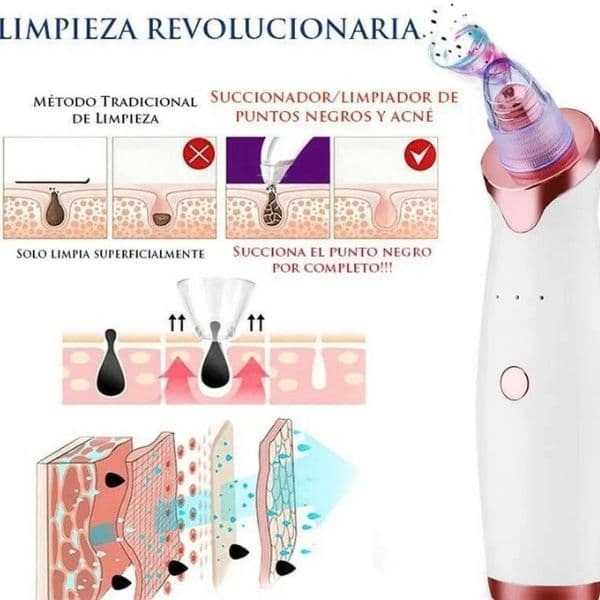 PoreClean Pro® – Miles en Ecuador ya lo usan para decirle adiós a los puntos negros y espinillas