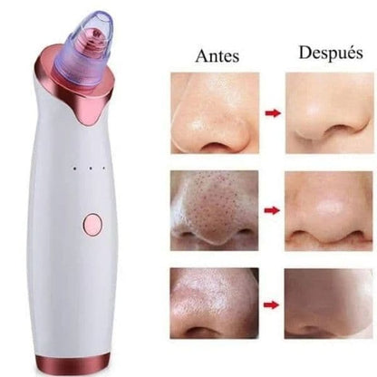 PoreClean Pro® – Miles en Ecuador ya lo usan para decirle adiós a los puntos negros y espinillas